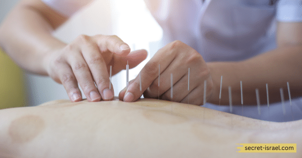 Chinese Medicine Acupuncture - Pinchasi Maayan