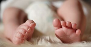 Is It Too Late? What Research Says About Treating Severe Pigeon-Toed Cases